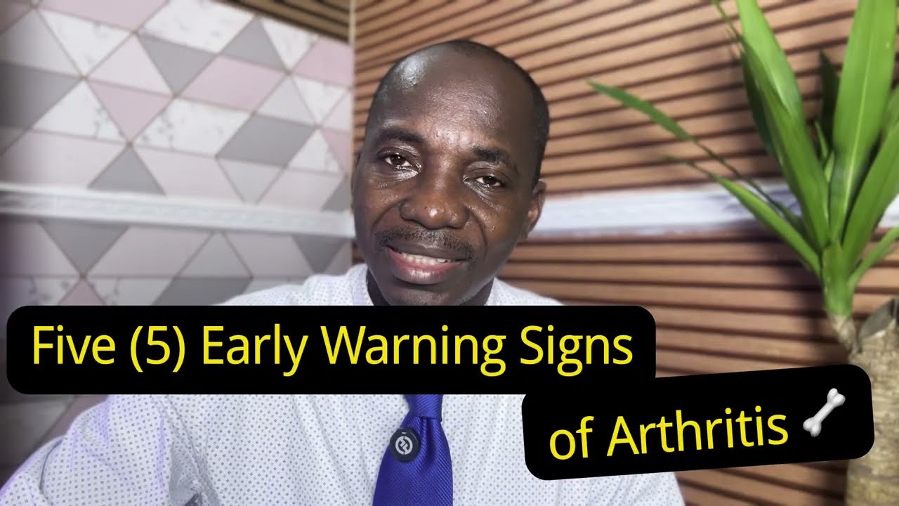 Early Warning Signs of Arthritis People Ignore! 