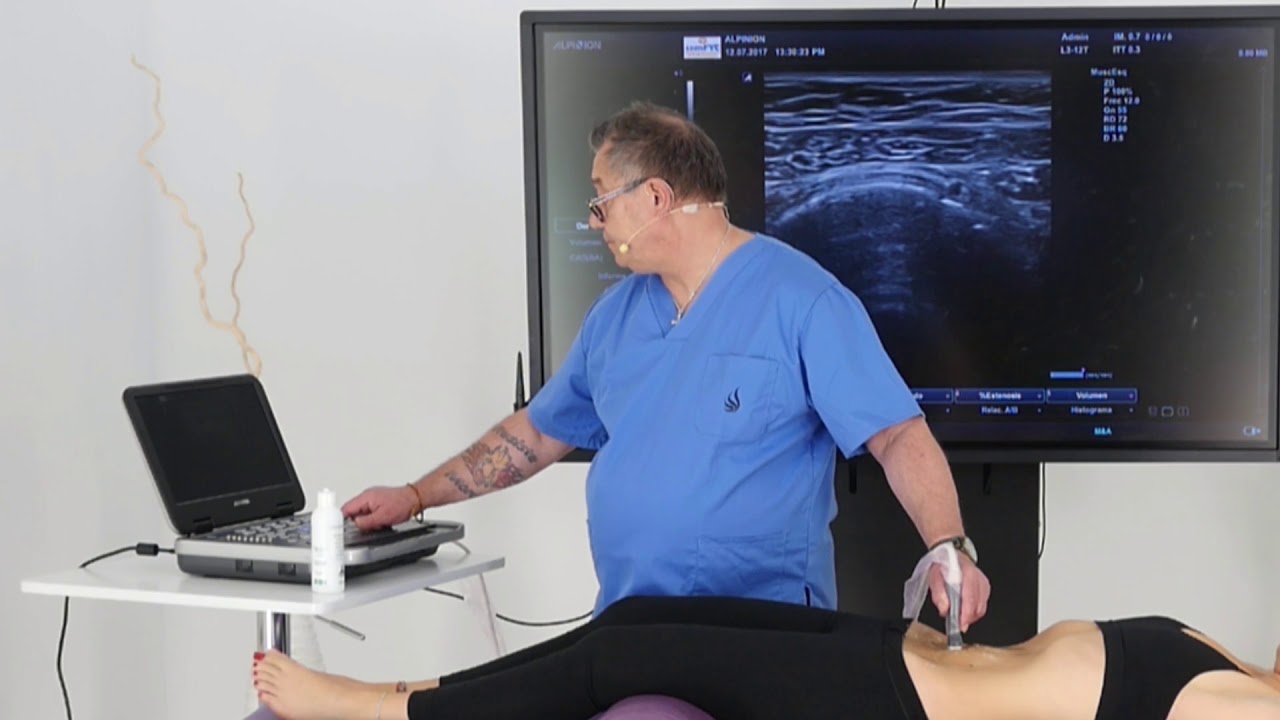 Diastasis, distancia cuando hacemos un crunch, Marcel Caufriez