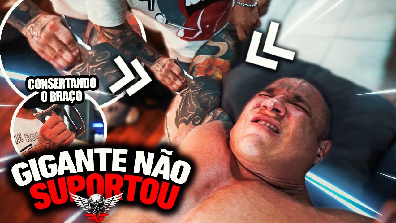 CONSERTANDO UM BRAÇO MACHUCADO - FABIO GIGA NUNCA SENTIU TANTA DOR *Miofascial Insana*