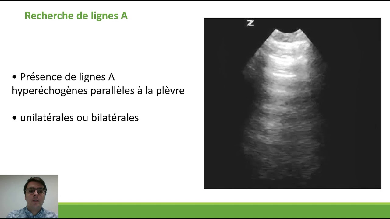 E-learning n°2 - Echographie pleuro-pulmonaire dans la dyspnée aiguë - Thèse François M.
