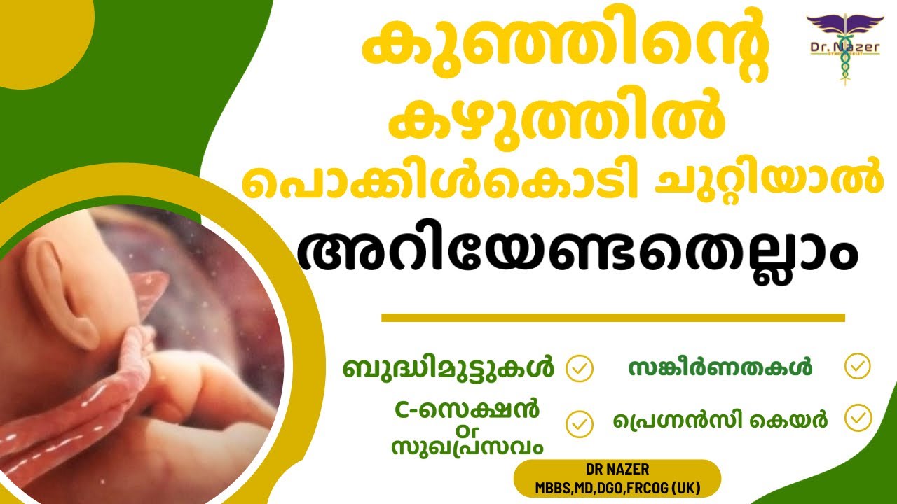 CORD AROUND THE NECK | MALAYALAM | കുഞ്ഞിന്റെ കഴുത്തിൽ പൊക്കിൾകൊടി ചുറ്റിയാൽ ? | Dr Nazer