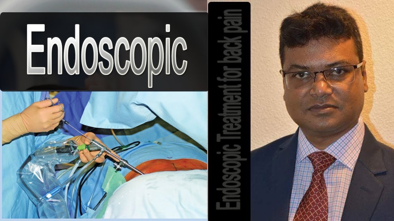 Endoscopic Treatment For Back Pain।Dr. Md. Nuruzzaman Khan।Doctors Tv BD