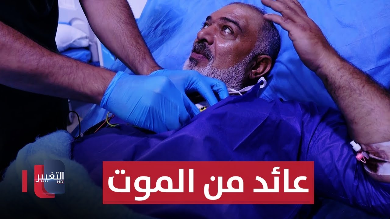 عراقي يعود الى الحياة بعد موته !! | تقرير