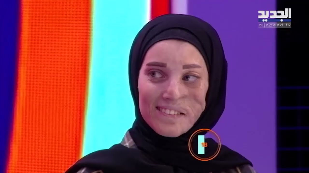 ضيفة رابعة الزيات تفقد أعصابها بسبب فتاة خسرت وجهها نتيجة التجميل وتصرخ داخل الاستوديو 
