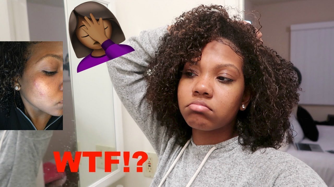 I USED RICE WATER FOR 3 DAYS ON MY FACE & THIS HAPPENED! 🤦🏾‍♀️