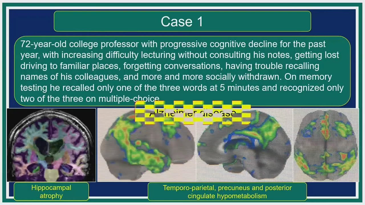 Pitfalls and Challenging Cases - Course Sample