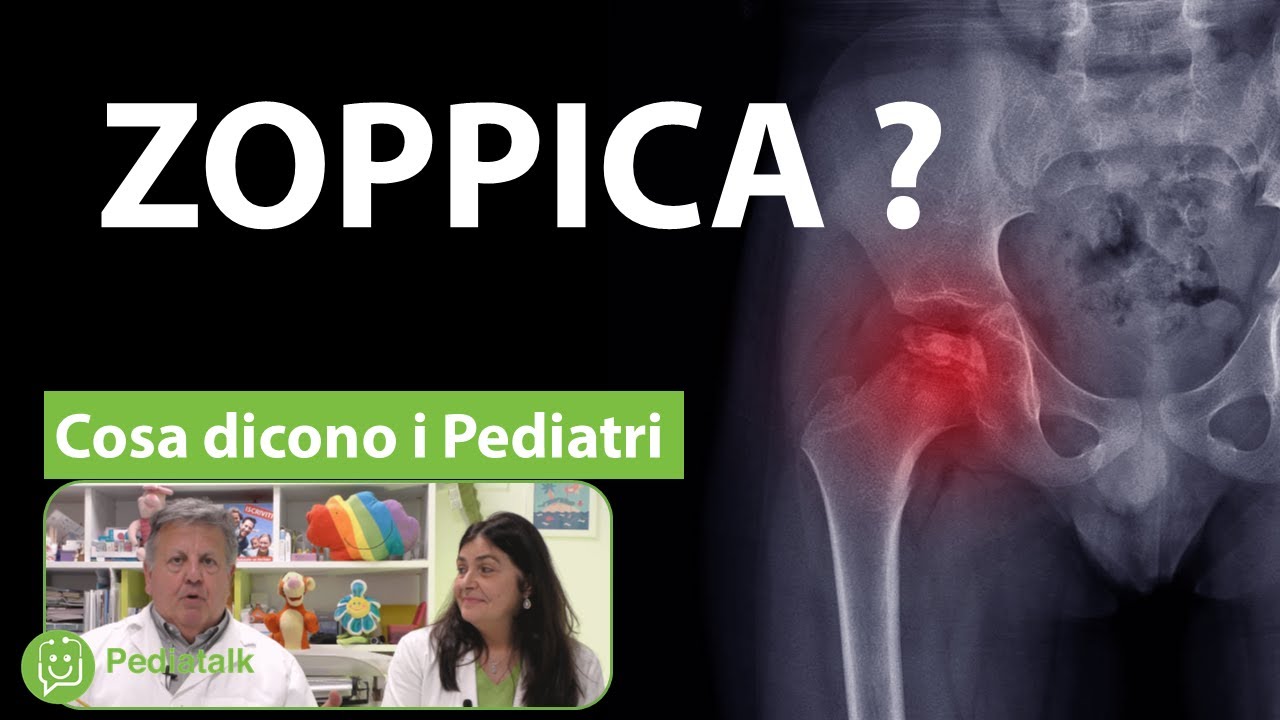 Sinovite dell'anca nei bambini. Cosa dicono i Pediatri.