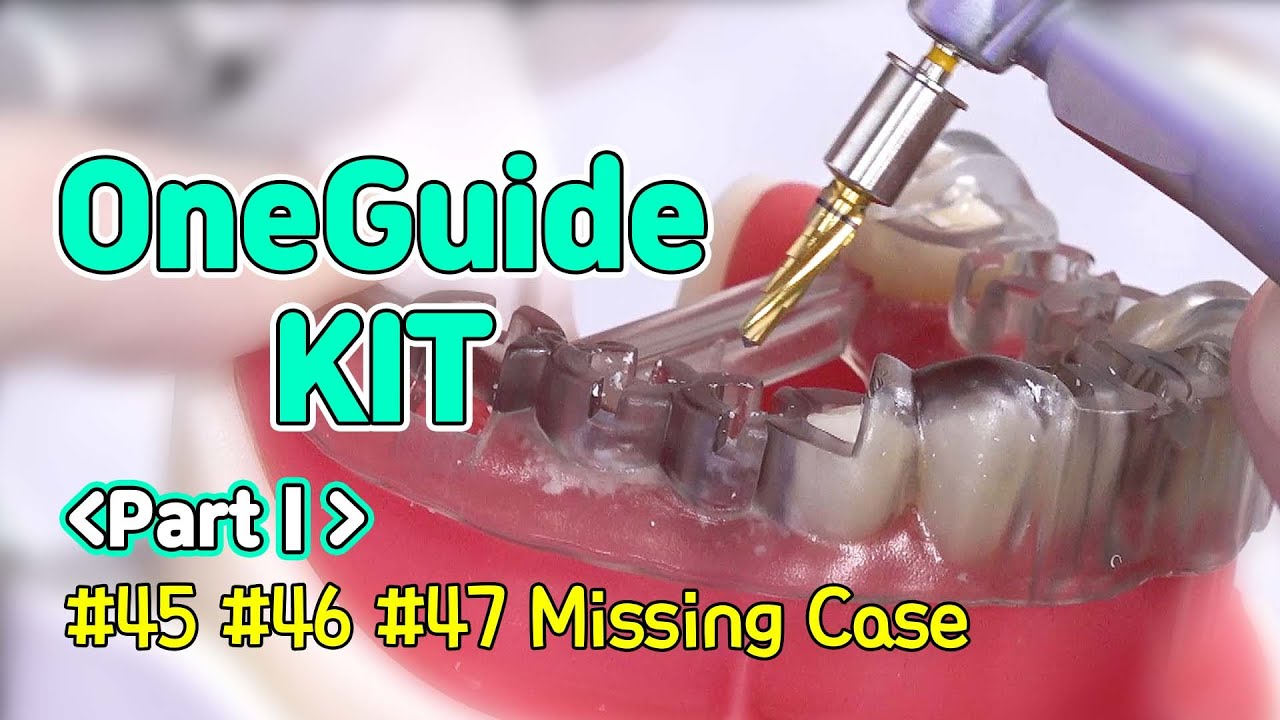 [EASY Hands-on] OneGuide KIT PartⅠ- #45, #46, #47 Missing Case
