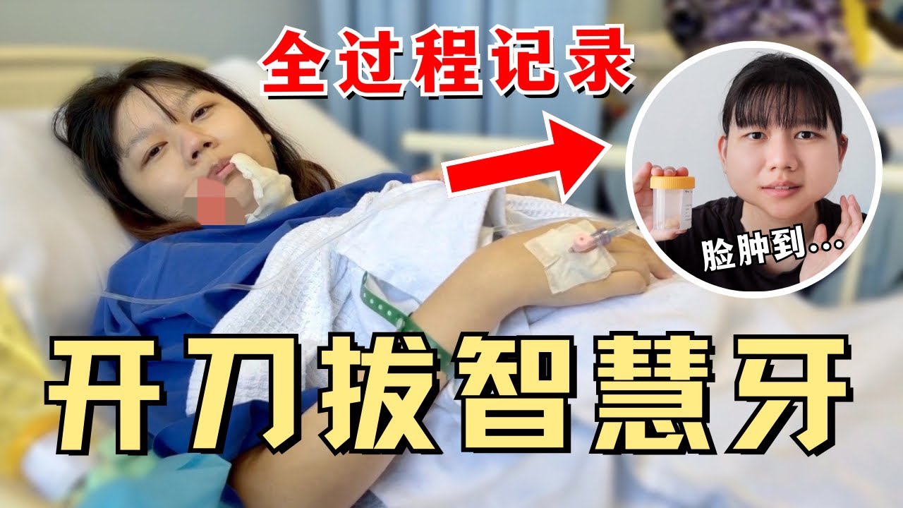 一次过拔4颗智慧牙！政府医院全麻开刀到底多少钱？(附申请流程)