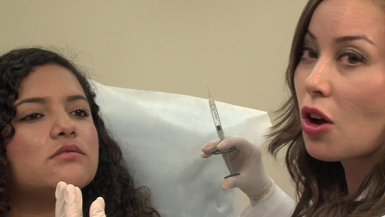 Volbella Lip Filler - Dr Kristel Polder