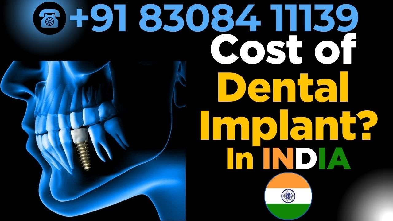 Cost of Dental Implants in India? 🤔 Get the Truth | PreciGem - Dr Mayur Khairnar