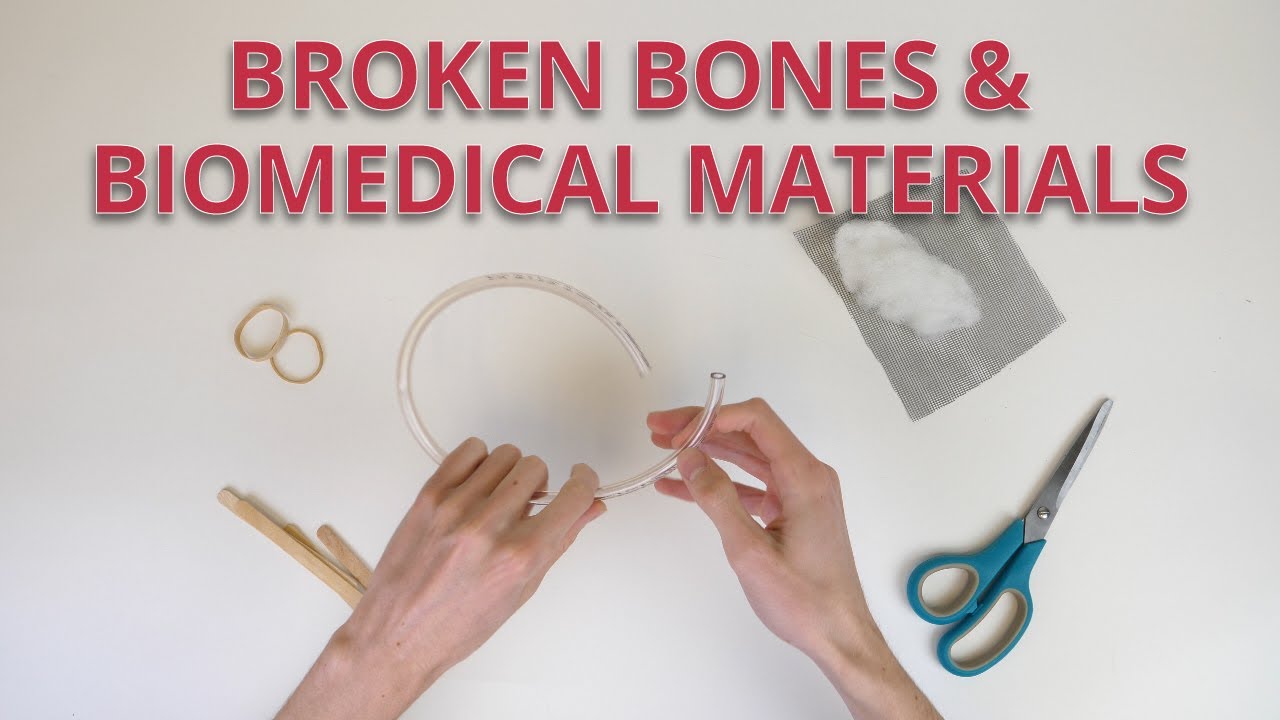 Broken Bones and Biomedical Materials