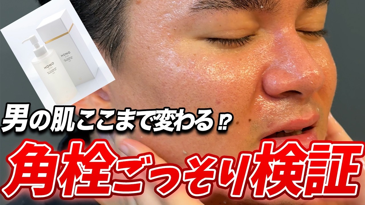 男性の角栓、ここまで出る？｜eスポーツで活躍する仏さんの肌ケア検証