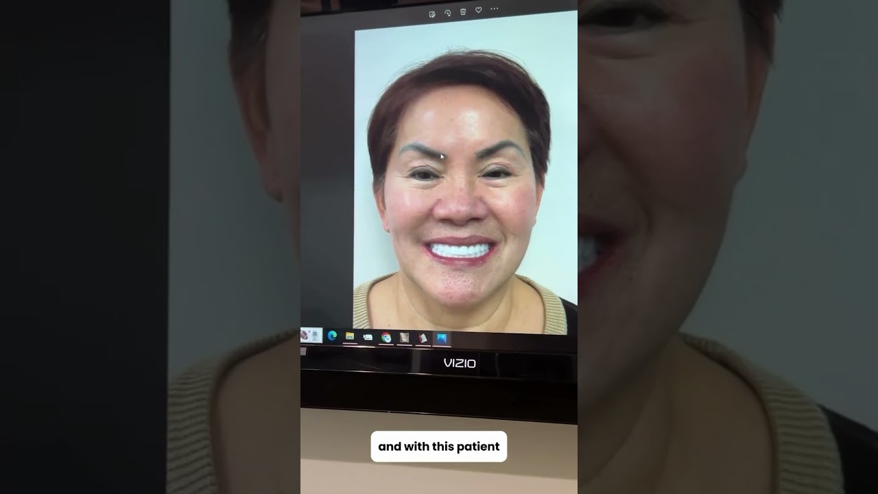 No Jaw Bone? No Problem! See How We Gave Real Teeth, Not Dentures!