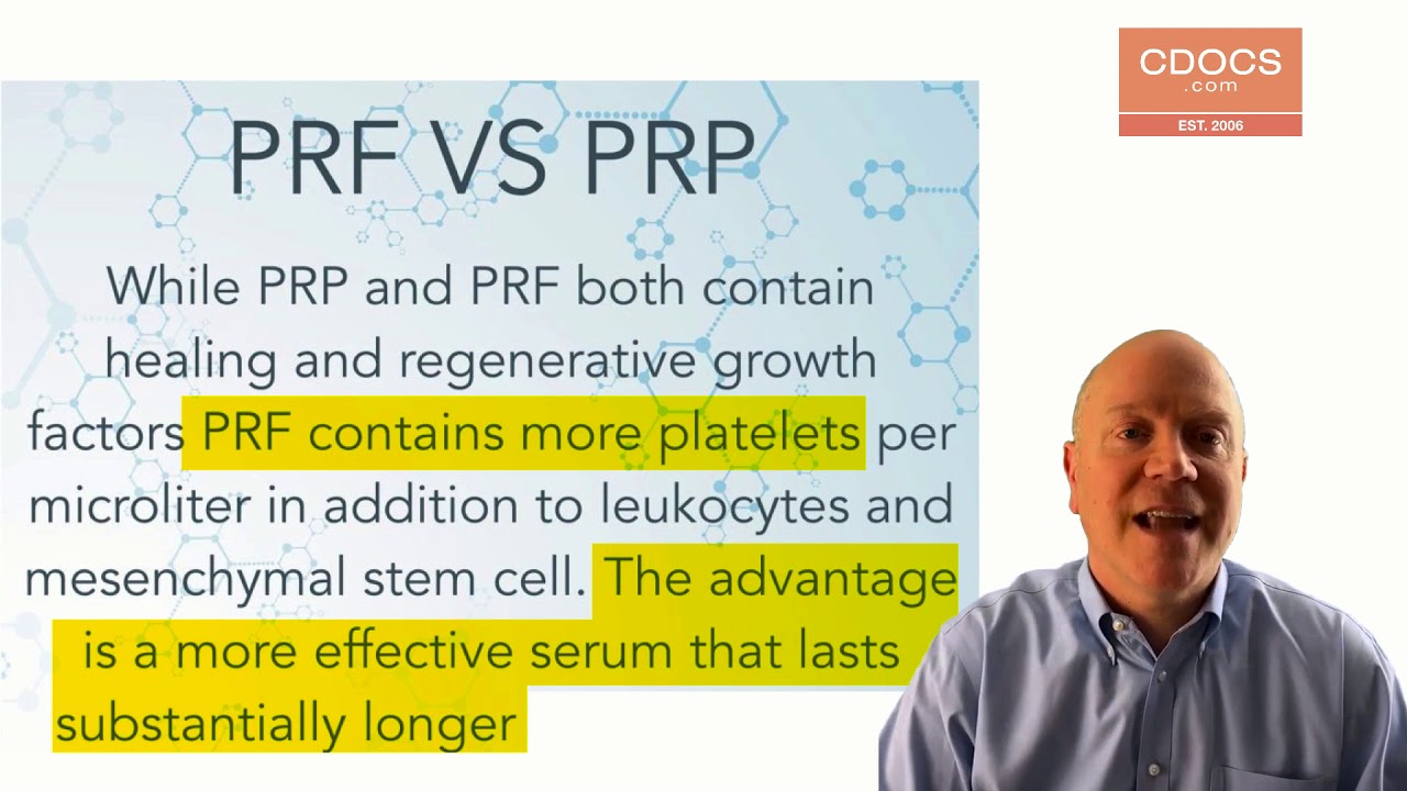 Tip of the Day: Introduction to PRF