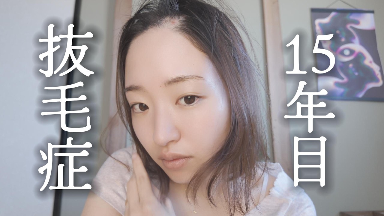 うちのメンヘラ彼女ちゃんとのエピソード話してみたら、伝説級だった【抜毛症】