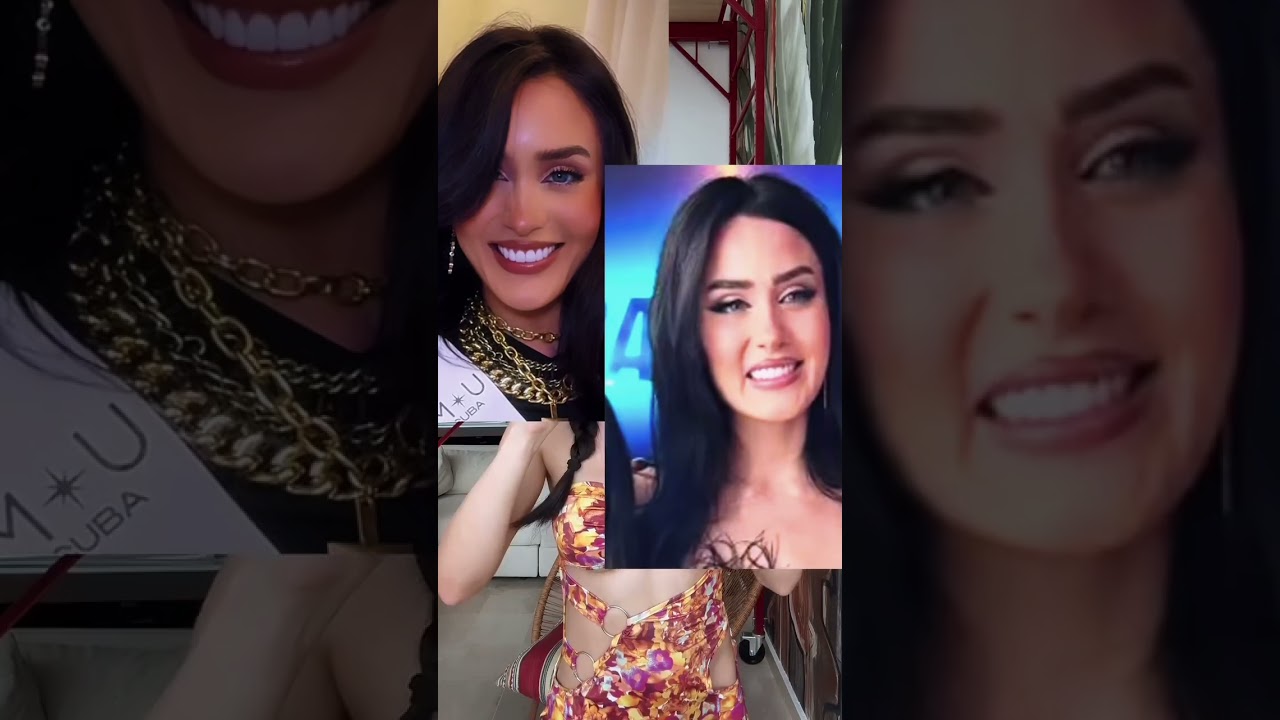 What really happened to my smile before a miss universe Cuba pageant 