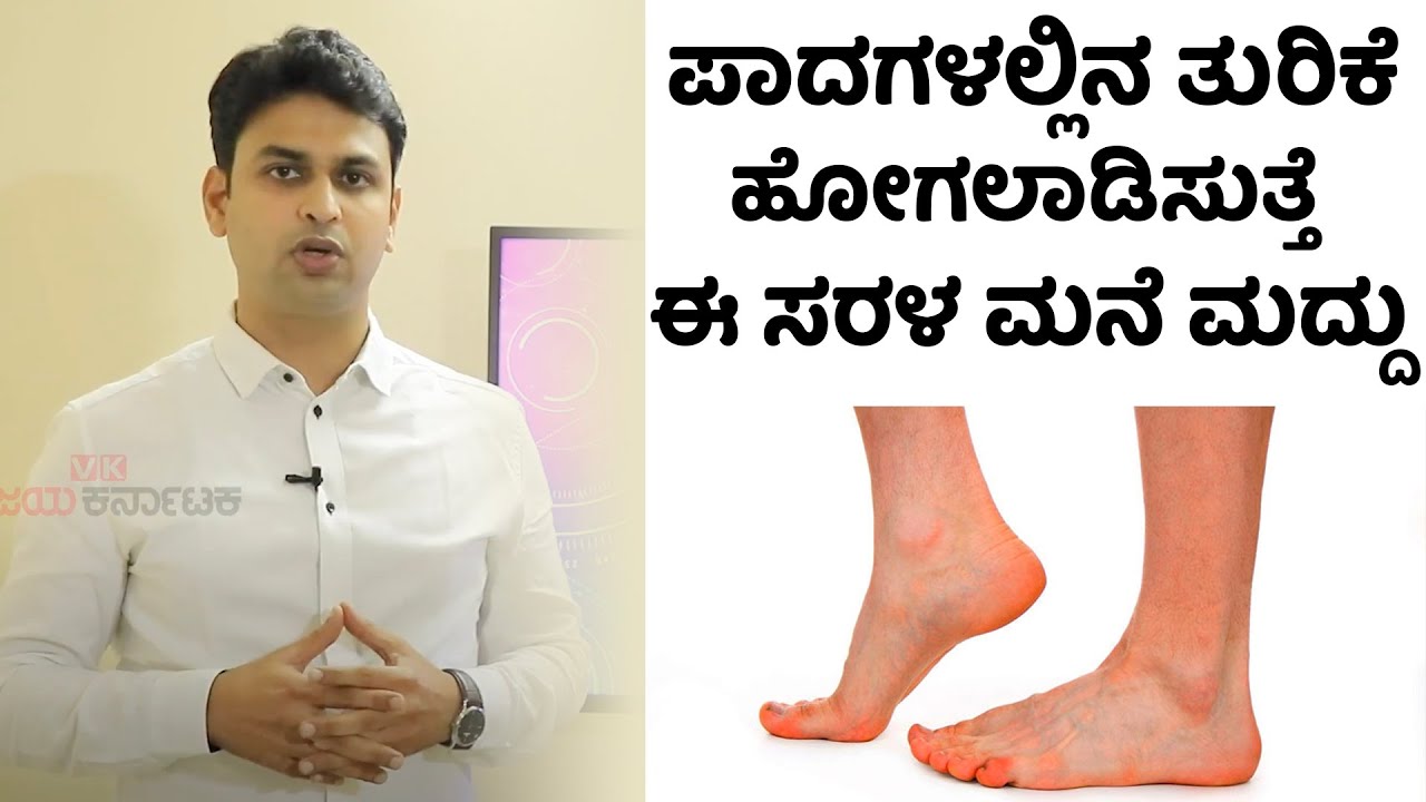 Itchy feet: Causes and How to Get Relief | Vijay Karnataka