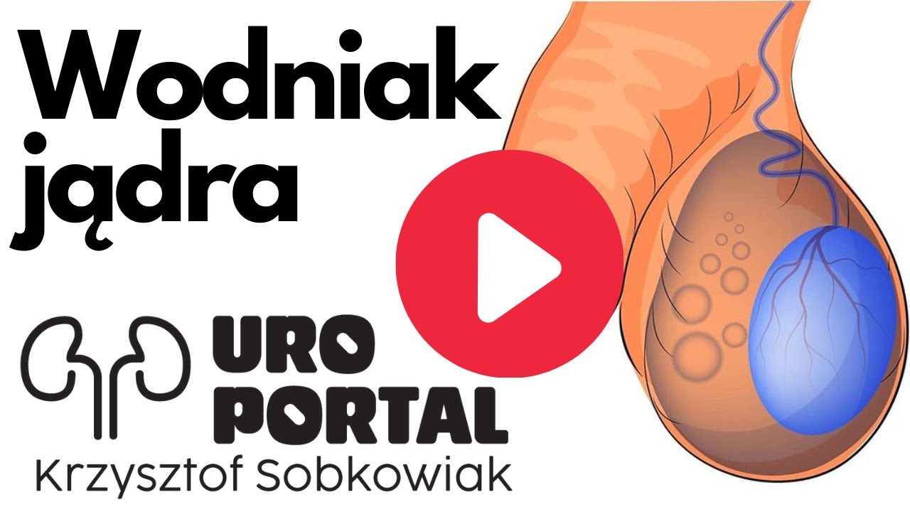 Wodniak jądra - przyczyny, objawy i leczenie u dzieci i dorosłych. Zdjęcia ze zabiegu URO PORTAL #9