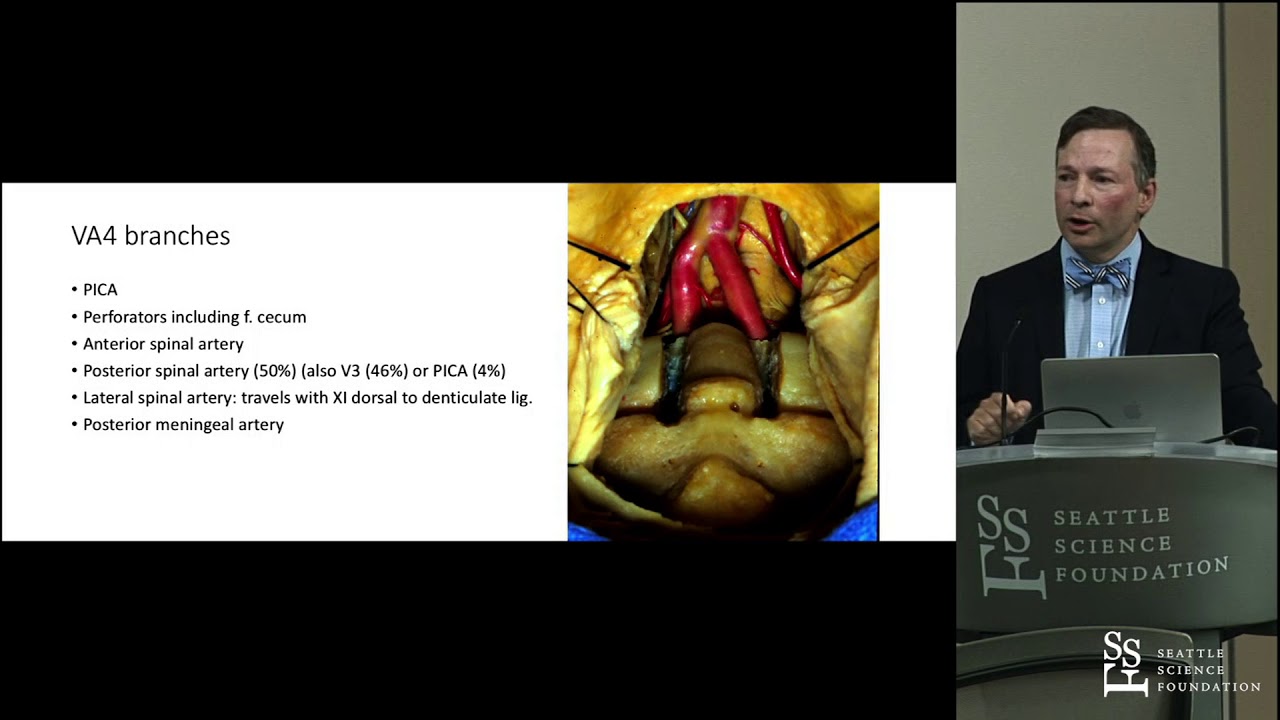 Anatomy of the Posterior Circulation