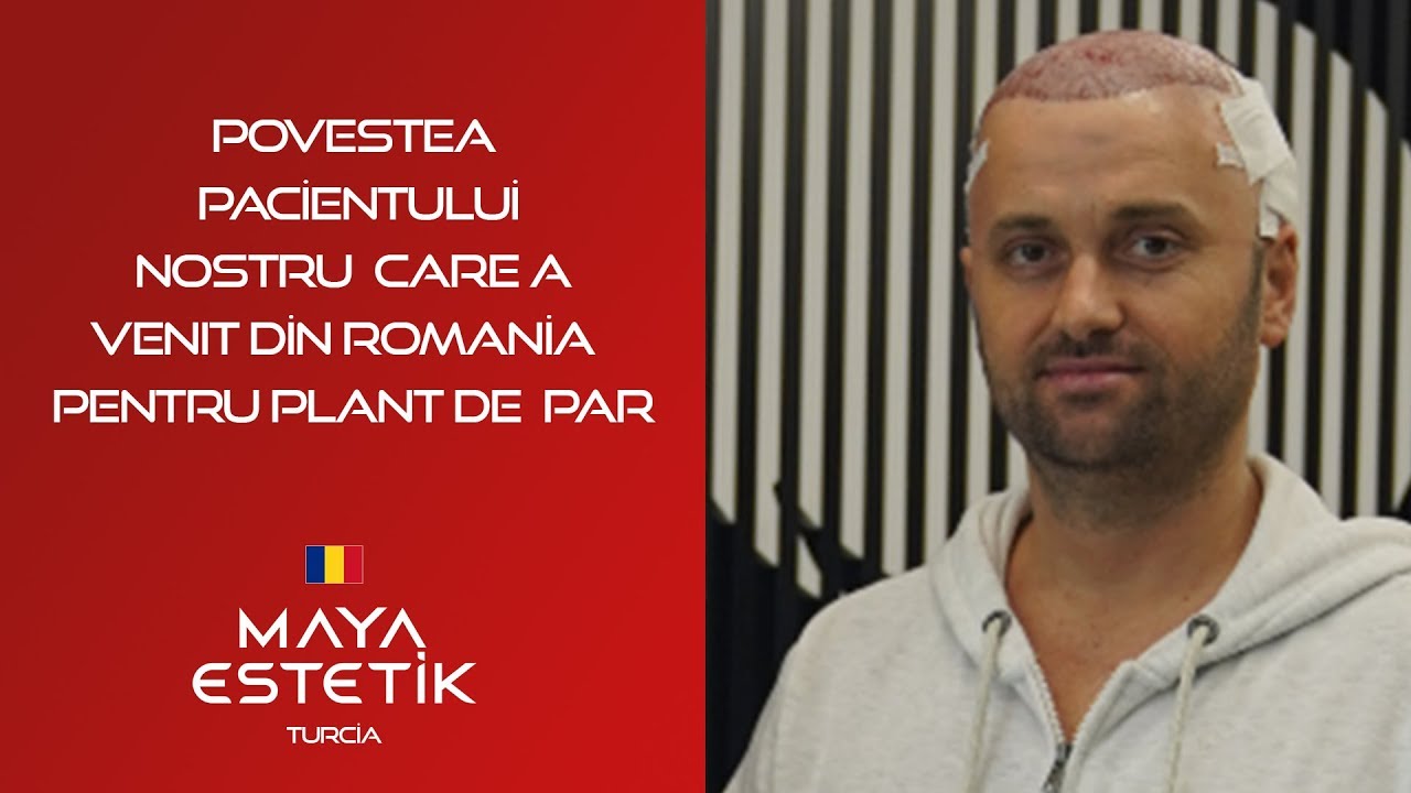 Povestea  Pacientului  Nostru  Care a Venit Din Romania  Pentru İmplant de Par