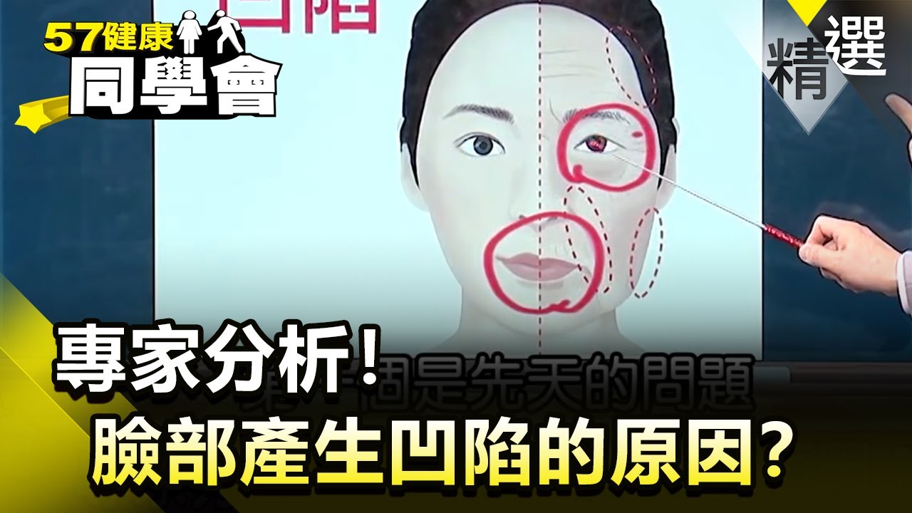 專家分析！臉部產生凹陷的原因？【健康同學會】精華篇｜隋安德 許晶晶