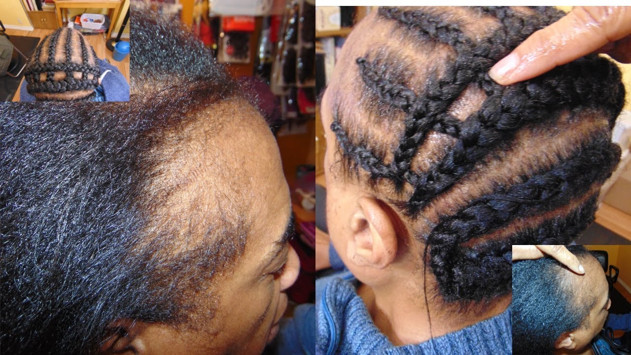 BEST BRAID PATTERN EVER TO COVER THIN BALD EDGES