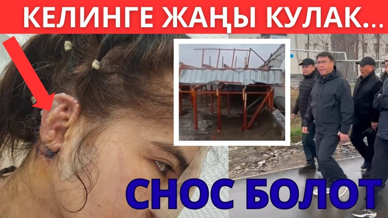 ЧАТЫР УЧКАНГА 200 МИҢ СОМ АЙЫП... Ошто СНОС дагы БОЛОТ... Кулагын Россиядагы доктурлар жасаган