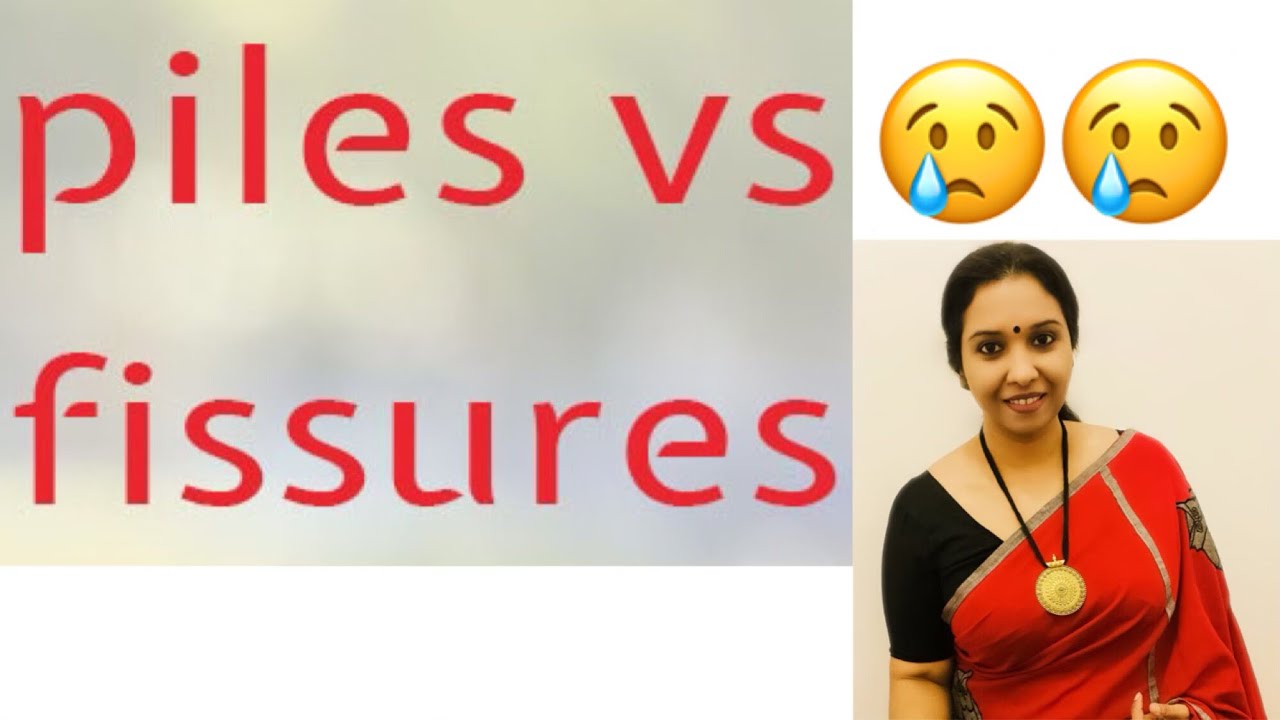 Piles vs Fissures // Understanding the difference