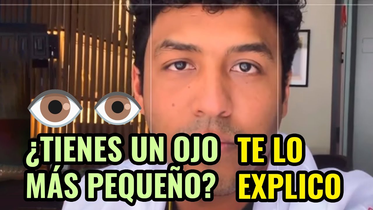 &iquest;Tienes un ojo m&aacute;s peque&ntilde;o? TE LO EXPLICO. #shorts | DR. RAWDY