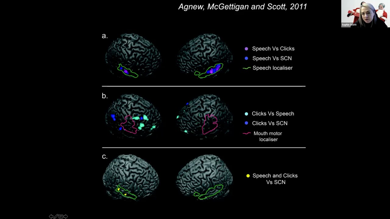Sound on the brain   insights from functional neuroimaging and Neuroscience. Prof Sophie Scott-UCL
