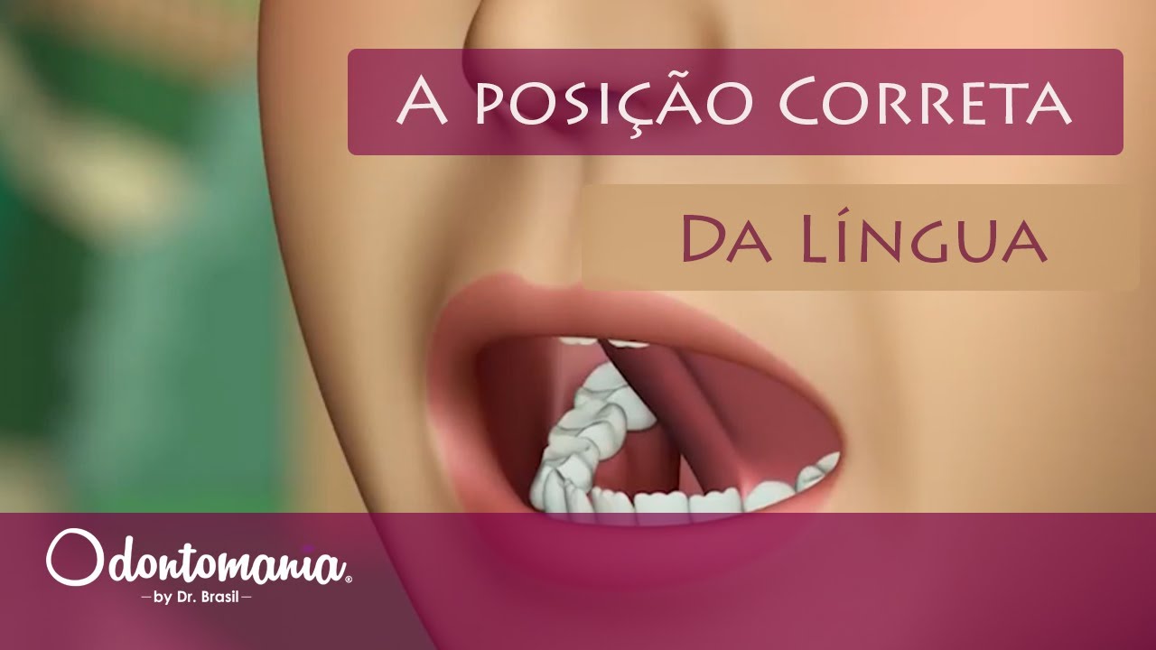 SAIBA COMO A LÍNGUA PODE FAZER COM QUE OS DENTES DAS CRIANÇAS FIQUEM TORTOS!