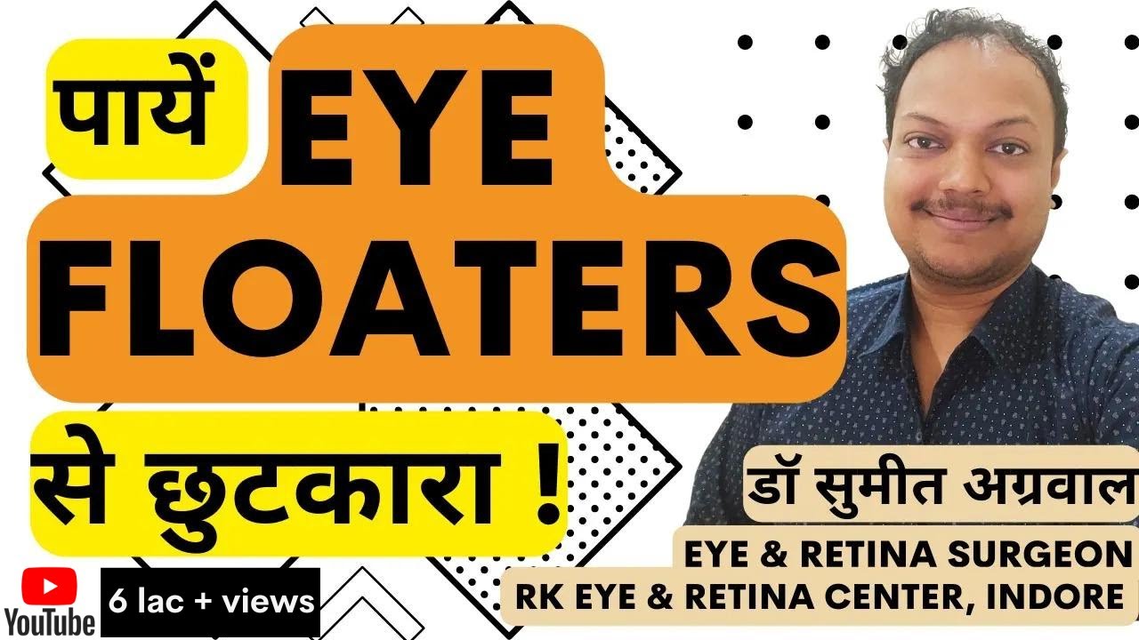 What are Eye Floaters ? आई फ्लोटर्स से पाएं छुटकारा !!