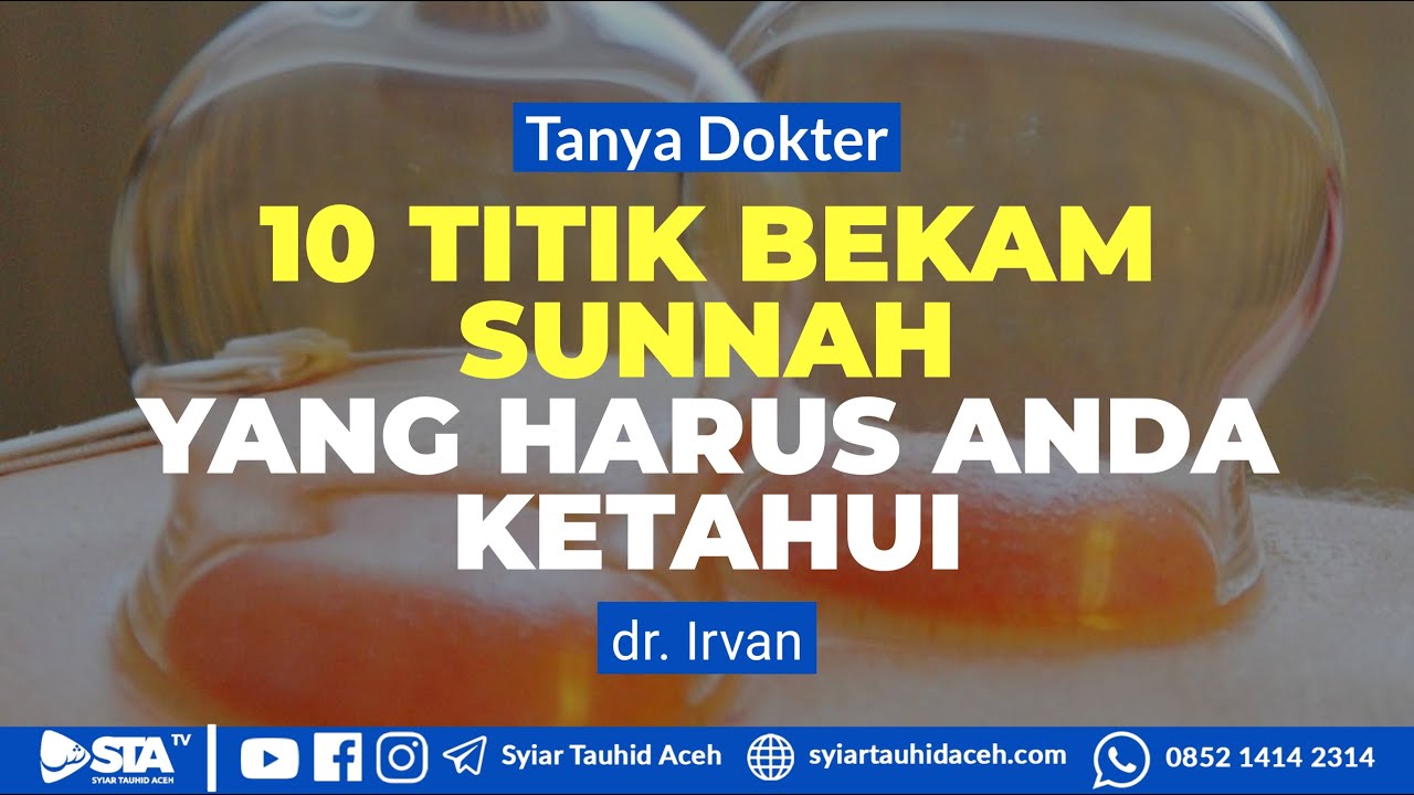 Tanya Dokter - 10 TITIK BEKAM SUNNAH YANG HARUS ANDA KETAHUI - dr  Irvan