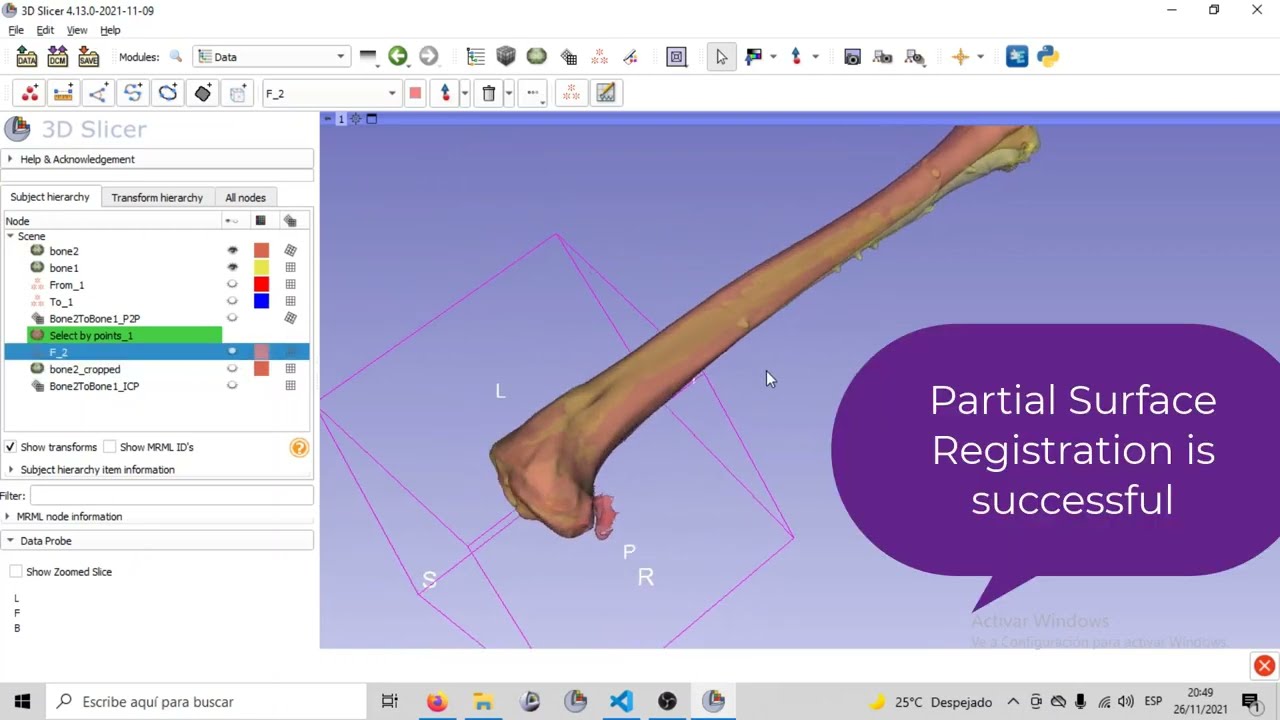 Partial Surface Registration on Slicer
