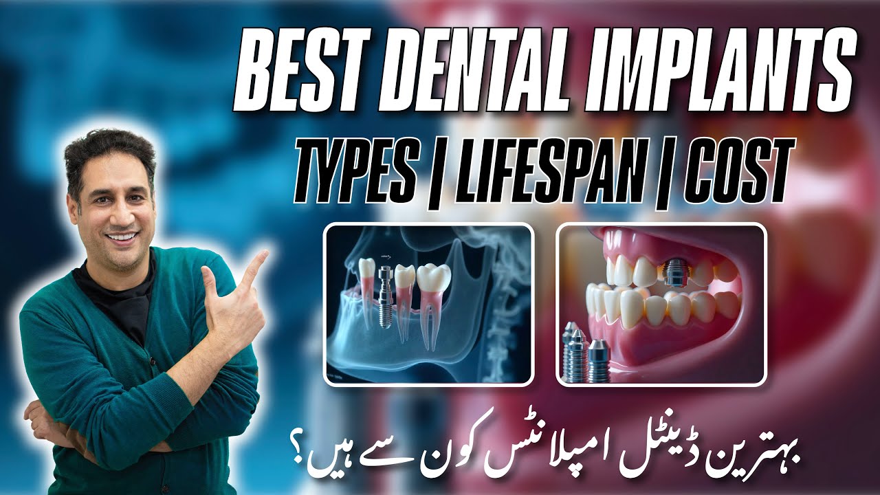Which Are Best Dental Implants in Pakistan? What's The Price, Life and Types Of an Dental Implant?
