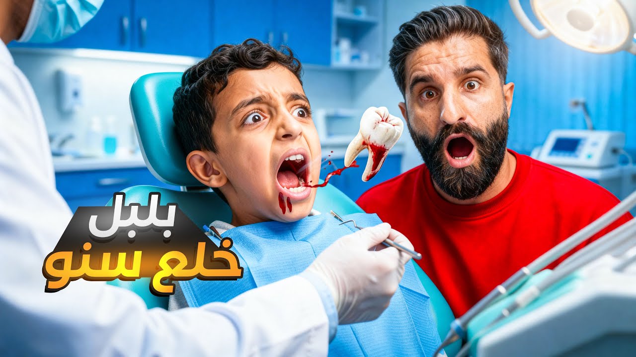 بلبل اكل حلو كتير وخرب سنو#اكسبلور #comedy #funny #شفا 