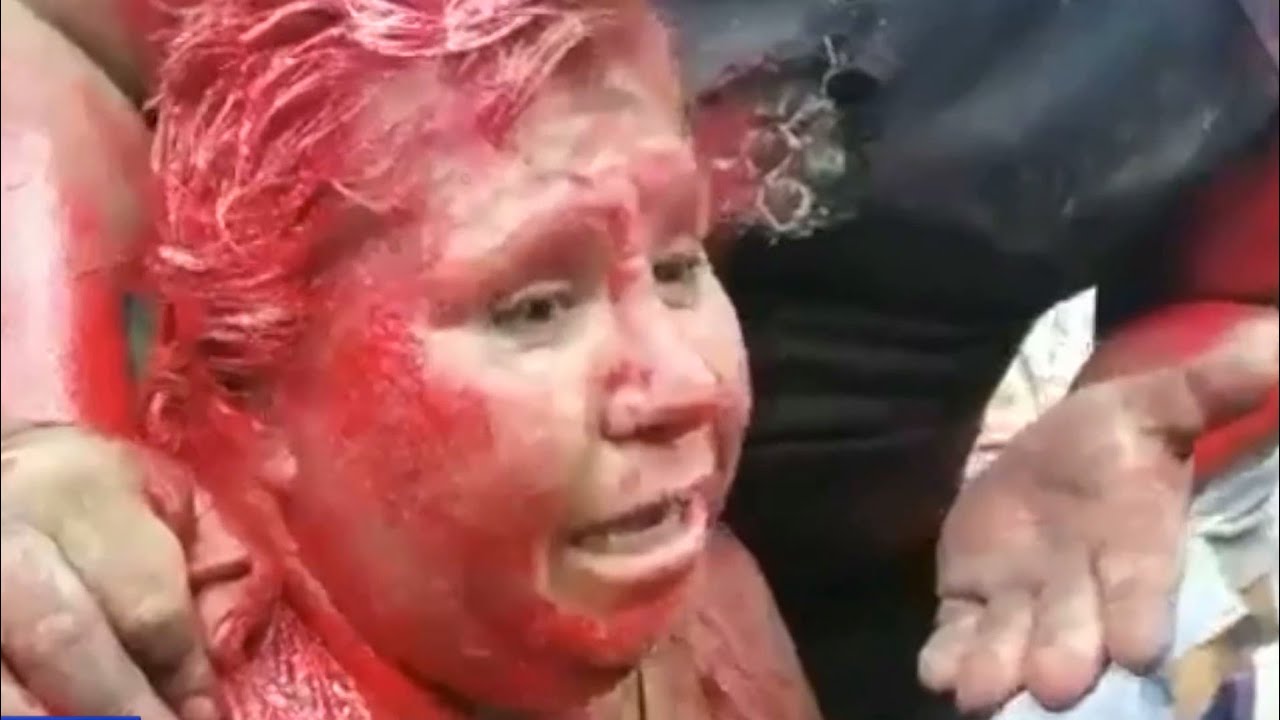 Clashes, unrest continue in Bolivia as more call for removal President Morales