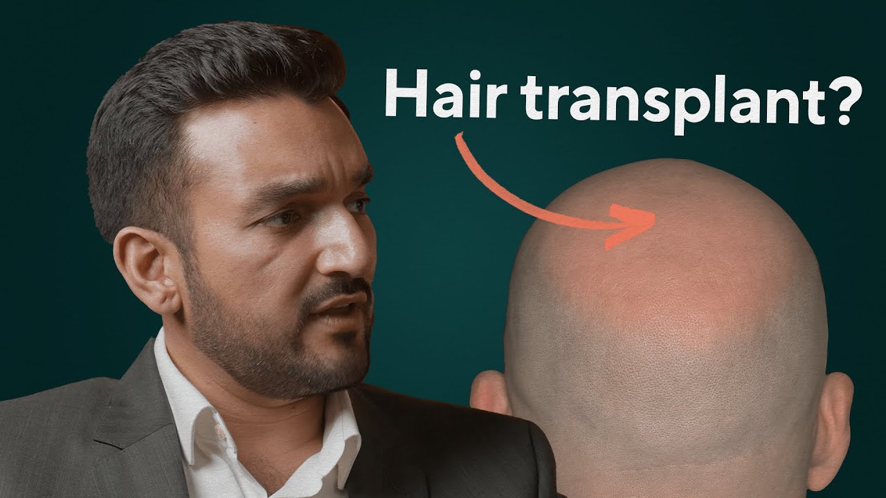 The Truth About Hair Transplants