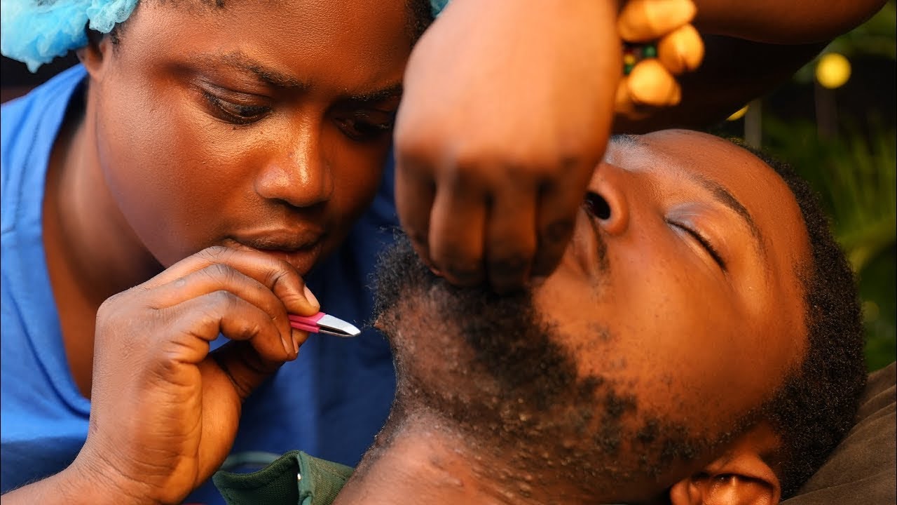 ASMR satisfying beard nitpicking,neck massage,soft gum  ingrown hair pullout, ear and nape massage