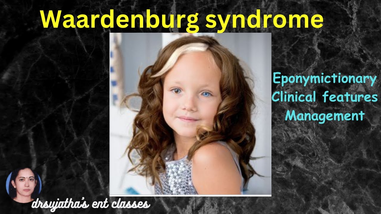 262.Waardenburg syndrome - Syndromes in ENT #surgeryeducation