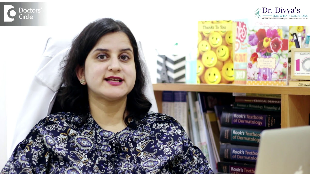 What is Alopecia Areata?   Dr  Divya Sharma