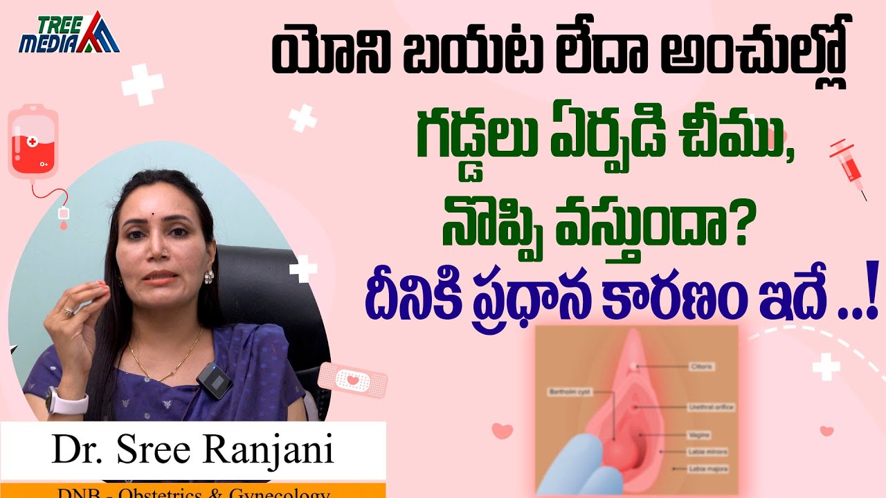 Bartholin Cyst In Telugu | Uterus Problems | Health Tips In Telugu || Tree Media