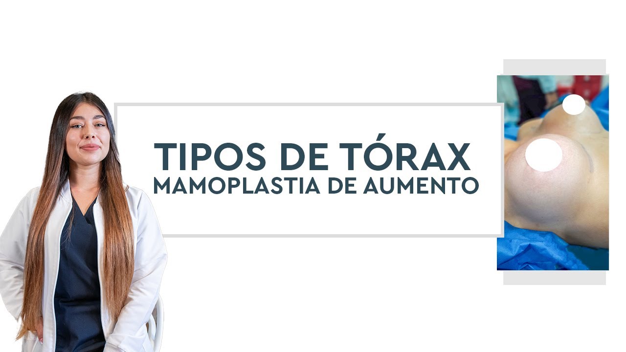 Tórax e implantes mamarios