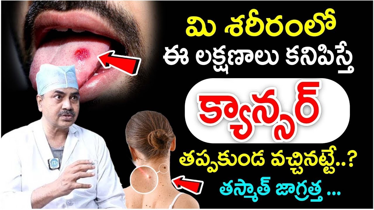 Dr CH Mohana Vamsy Exclusive Latest Interview | Mohana Vamsy About Cancer Symptoms | iDream Health