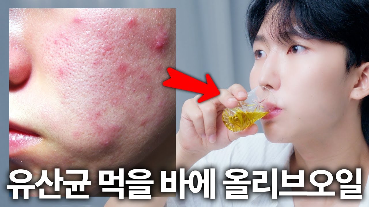 올리브오일 하나로 피부 장벽·여드름 싹 다 좋아집니다
