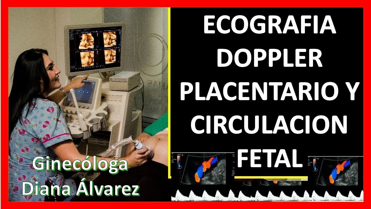 ECOGRAFIA DOPPLER PLACENTARIO Y FETAL, POR GINECOLOGA DIANA ALVAREZ