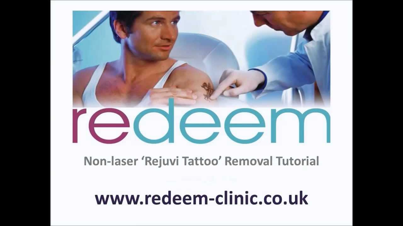 New Tattoo Removal - Best Non Laser treatment - full tutorial - Before & After - How it works