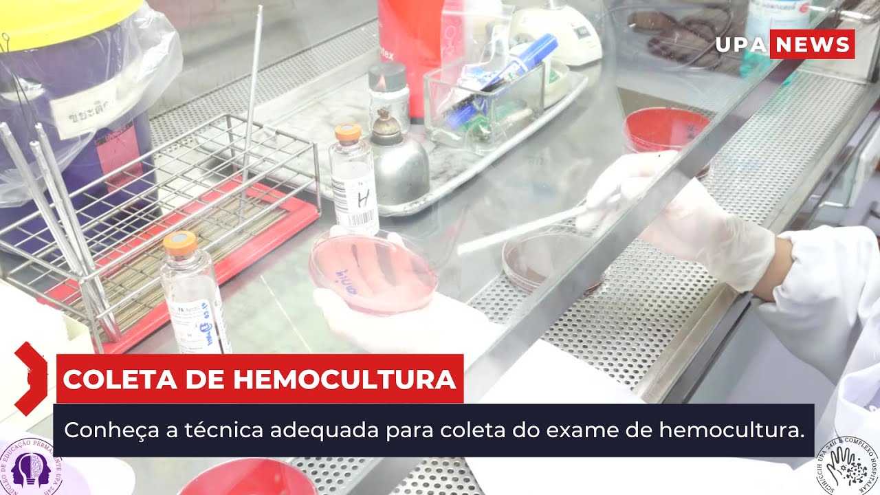 COLETA DE HEMOCULTURA - UPA BENTO GONÇALVES/RS