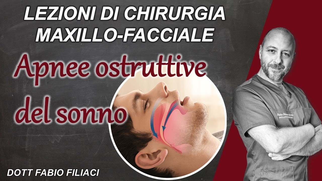Lezioni di chirurgia maxillo facciale: La sindrome delle apnee del sonno
